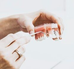 tandretning invisalign